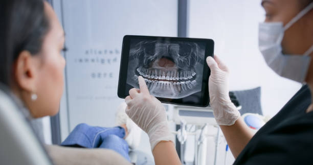 Licensed Tooth Extraction service in San Luis Obispo, CA - Smile Center Dentistry